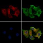 XRN1 Polyclonal Antibody