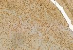 MYOCD Antibody in Immunohistochemistry (Paraffin) (IHC (P))