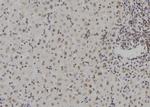 ZNF709 Antibody in Immunohistochemistry (Paraffin) (IHC (P))