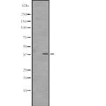 SNAPC3 Antibody in Western Blot (WB)
