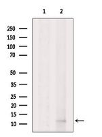 DIRC1 Antibody in Western Blot (WB)