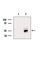 DMRTB1 Polyclonal Antibody