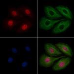 HEXIM2 Polyclonal Antibody