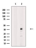 hnRNP AB Polyclonal Antibody