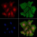 MOB1 Polyclonal Antibody