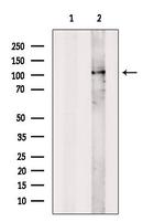 TOPORS Antibody in Western Blot (WB)