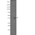 VSX1 Polyclonal Antibody
