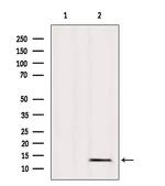 MRPL36 Polyclonal Antibody