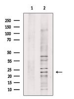 WARS2 Polyclonal Antibody