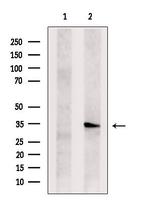 TSSC4 Polyclonal Antibody