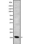CYB5B Antibody in Western Blot (WB)