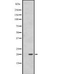 FAIM Antibody in Western Blot (WB)