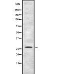 FGFBP1 Polyclonal Antibody