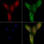 HSPA12A Polyclonal Antibody