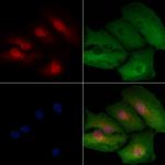 HSPB9 Polyclonal Antibody