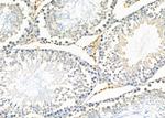 IGFBPL1 Polyclonal Antibody