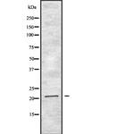 Interferon alpha-2 Polyclonal Antibody