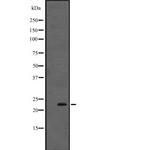 Interferon alpha-4/10/14 Antibody in Western Blot (WB)