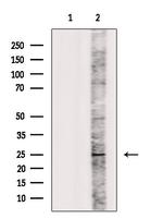 IL1F6 Polyclonal Antibody