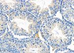 ITGA10 Antibody in Immunohistochemistry (Paraffin) (IHC (P))