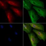 Integrin beta 7 Polyclonal Antibody