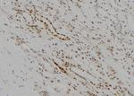 KDM5D Polyclonal Antibody