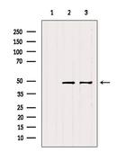 Cytokeratin 31/33A/33B Antibody in Western Blot (WB)