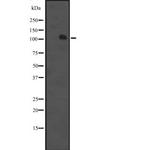 MCF2 Polyclonal Antibody