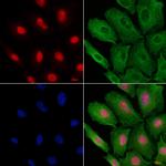 PAK1IP1 Polyclonal Antibody