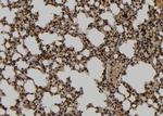 TUBD1 Antibody in Immunohistochemistry (Paraffin) (IHC (P))