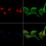 NSA2 Polyclonal Antibody