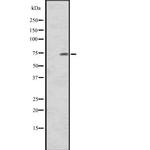 CNNM1 Polyclonal Antibody