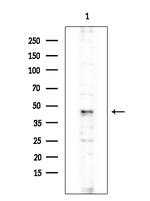 MCM9 Antibody in Western Blot (WB)
