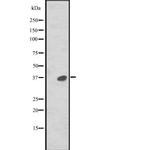 MAPRE2 Polyclonal Antibody