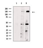 SYCP2 Antibody in Western Blot (WB)