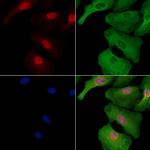 KLF14 Polyclonal Antibody