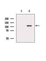 SMARCAD1 Polyclonal Antibody
