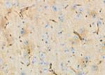 ZDHHC13 Antibody in Immunohistochemistry (Paraffin) (IHC (P))