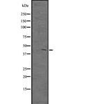 PKNOX1 Polyclonal Antibody