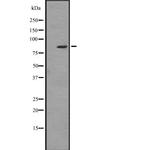 ZBTB16 Polyclonal Antibody