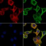 CYP7A1 Polyclonal Antibody