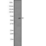 CYP4F12 Polyclonal Antibody
