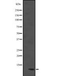 DYNLL1 Polyclonal Antibody