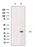 ING5 Polyclonal Antibody