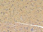 RASAL2 Polyclonal Antibody
