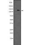 RASAL2 Antibody in Western Blot (WB)