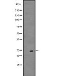 FGF19 Polyclonal Antibody