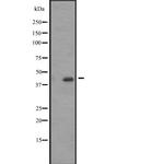 ACTA1/ACTA2/ACTC1 Polyclonal Antibody