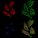 DYRK4 Polyclonal Antibody