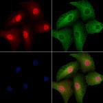 NRK Polyclonal Antibody